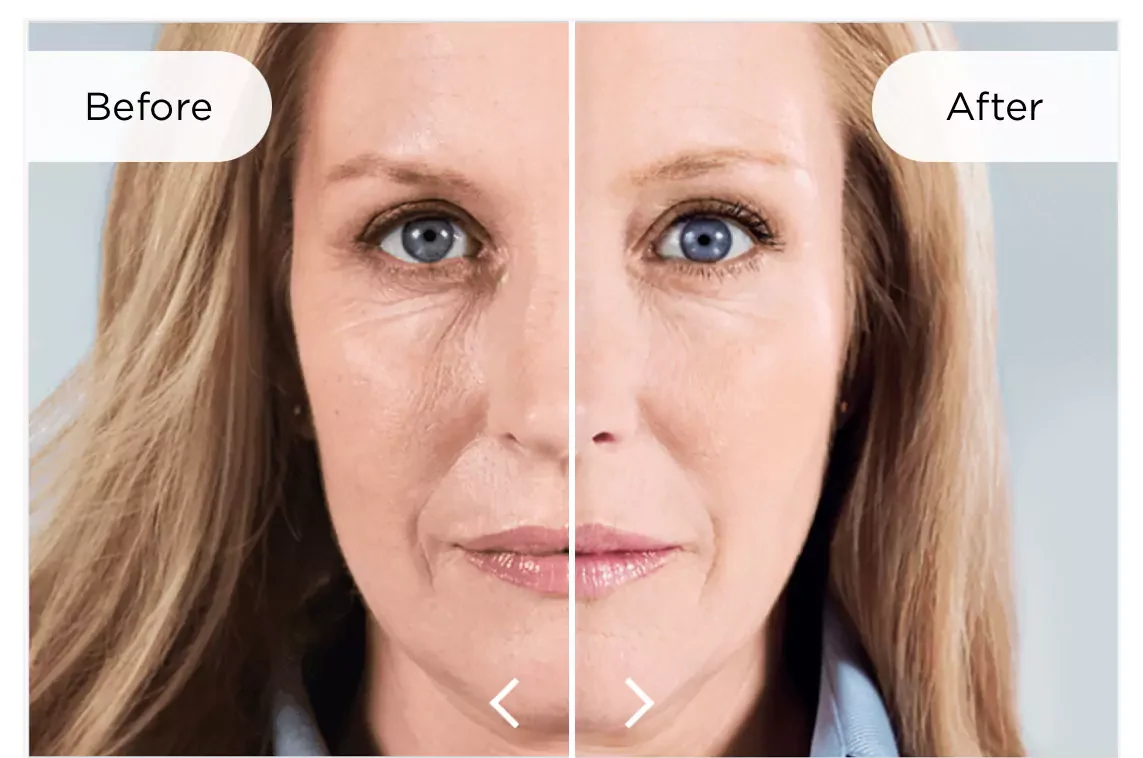 a woman with blue eyes and a woman with blue eyes - New Project